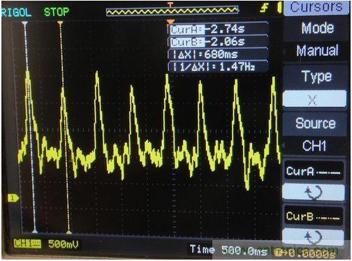 可穿戴技術(shù)在醫(yī)學(xué)領(lǐng)域遍地生花:脈搏血氧計(jì)問(wèn)世