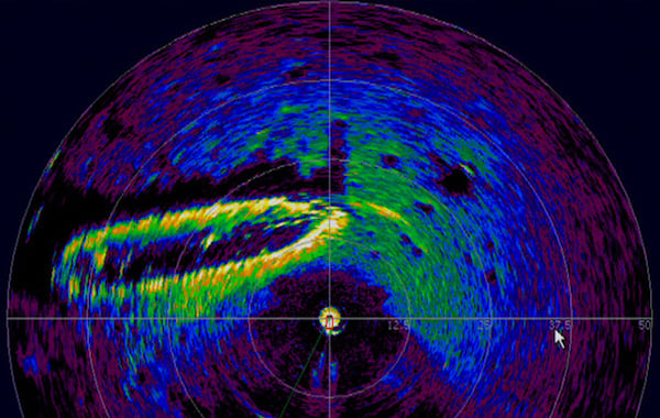 什么是激光雷達(dá)以及如何使用它？