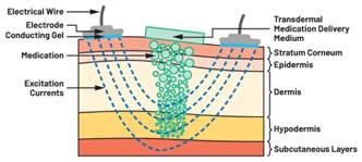  圖5.人體皮膚分層橫截面以及TMD和生物阻抗測量  考慮到生物阻抗分析的無創(chuàng)性，使用兩個金屬電極代表電氣傳感器，連接模擬前端(AFE)電路和患者皮膚。這個金屬與非金屬的接觸點是構成整個電路的另一個關鍵部分，連接了AFE和人體電氣模型。電荷載體（電極中的電子和人體內的離子）之間的相互作用可能對這些傳感器的性能產(chǎn)生重大影響，需要根據(jù)每種應用進行具體考慮。首先，金屬與離子溶液接觸的相互作用導致金屬表面附近溶液中離子濃度的局部變化。這種現(xiàn)象會改變電極下方區(qū)域的電荷中性，導致金屬周圍的電解質電位與溶液其余部分不同，從而在金屬和電解質主體之間產(chǎn)生一個電位差，即常說的“半電池電位”。其次，注入電流的直流分量會導致電極極化。  表1.各種電極類型和相應的半電池電位  金屬及反應  半電池電位(V)  Al → Al3+ + 3e- Al → Al3+ + 3e-  –1.706 –1.706  Ni → Ni2+ + 2e- Ni → Ni2+ + 2e-  –0.230 -0.230  H2 → 2H+ + 2e- H2 → 2H+ + 2e-  0.000 (by definition) 0.000（根據(jù)定義）  Ag + Cl- → AgCl + e- Ag + Cl- → AgCl + e-  +0.223 +0.223  Ag → Ag+ + e- Ag → Ag+ + e-  +0.799 +0.799  Au → Au+ + e- Au → Au+ + e-  +1.680 +1.680  這是一種不良現(xiàn)象，往往導致電極性能下降。這些考量表明，電極也需要定義適當?shù)碾姎饽Ｐ停▍⒁妶D6）。我們可以將干電極表示為具有三個串聯(lián)元件的電路：一個用于模擬半電池電位(EHC)的直流電源；一個用于模擬金屬和非金屬（人體）之間接觸的RC并聯(lián)電池(Rd||Cd)；以及一個用于模擬電極金屬的電阻Rs。